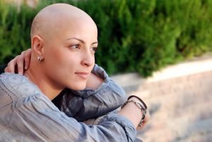 bald woman